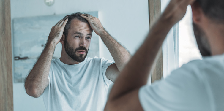 man with alopecia