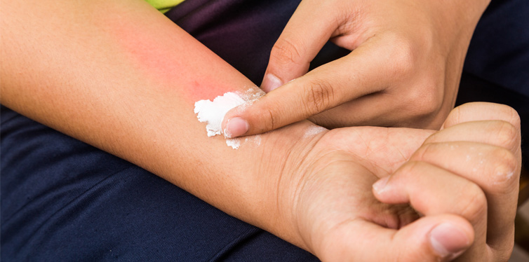 baking soda for itchy skin