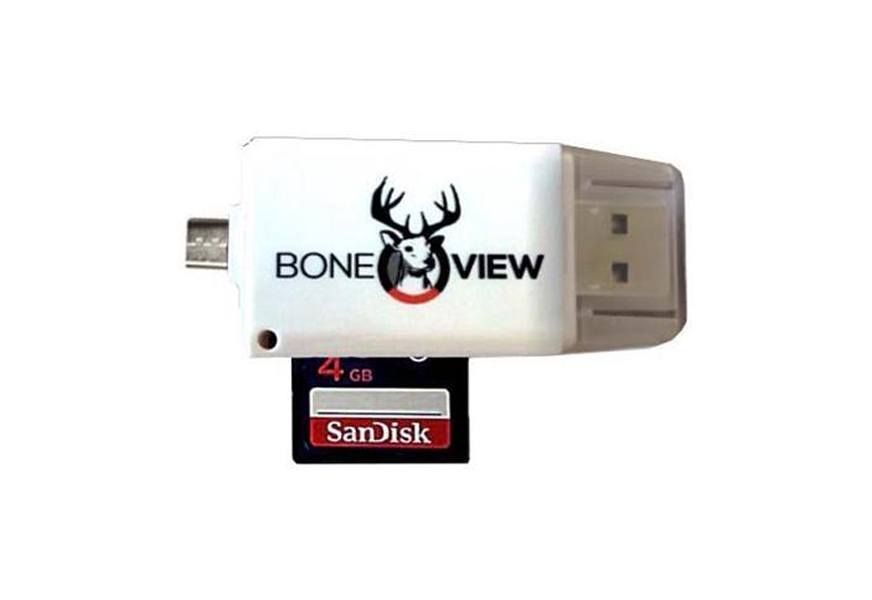 boneview viewer for apple iphone & ipad