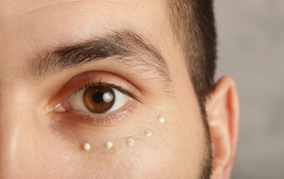 man with eye cream faq